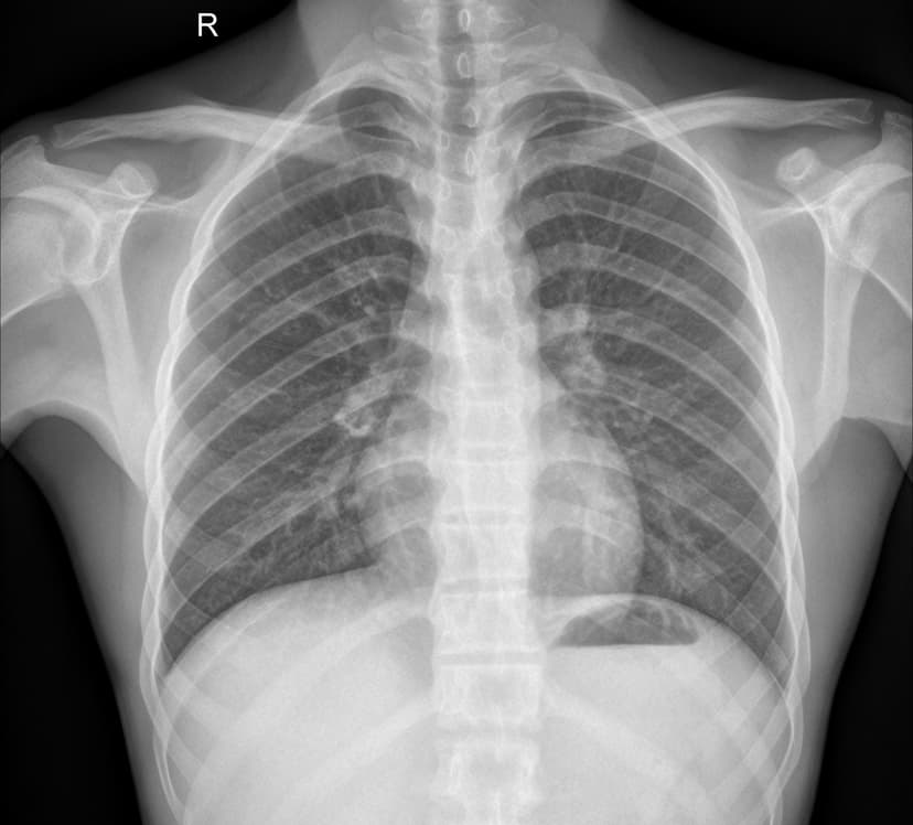 Chest X-Ray Pneumonia Detection App - AI-powered medical imaging analysis using ResNet18 and FastAPI